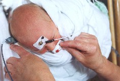 infant hearing screening
