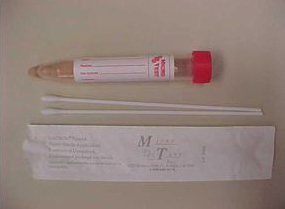 female GC and chlamydia test swab