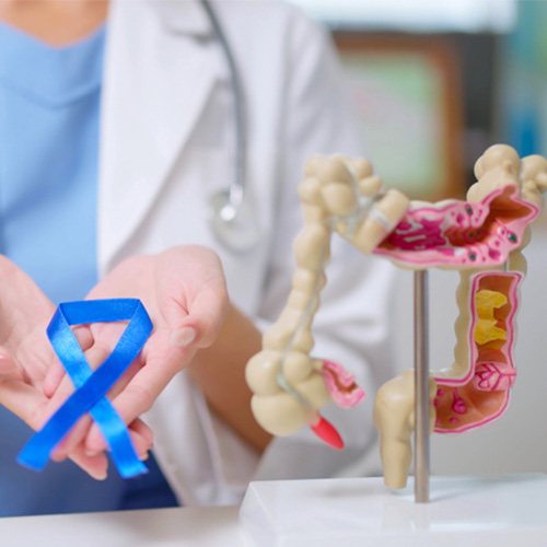 Protect Your Gut Health: What to Know about Colorectal Cancer Screening
