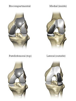 diagram of areas of the knee