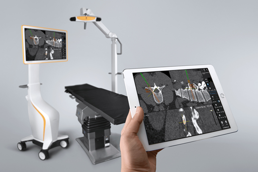 BrainLab Navigation System for Spinal Surgery