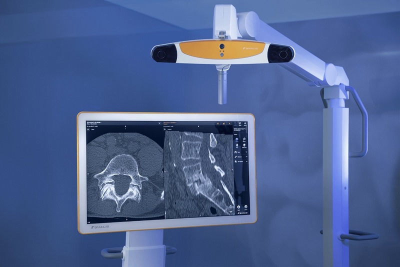 BrainLab Navigation System for Spinal Surgery