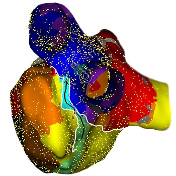 3d heart mapping