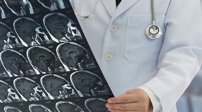 doctor examines brain scan