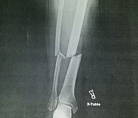 X-ray