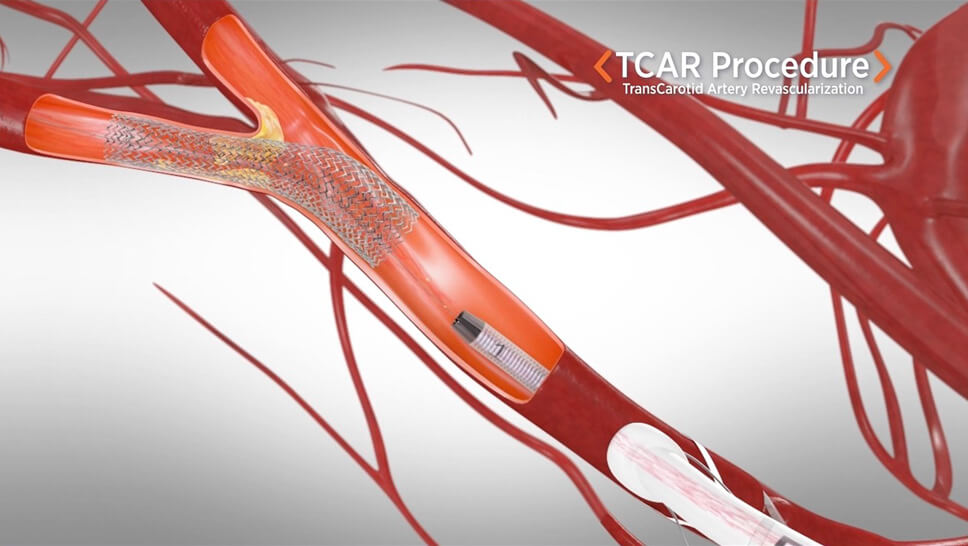 Vascular Surgery | McLaren Health Care