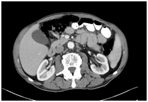 ct scanner