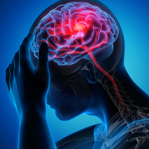 Can Cold Weather Increase Your Risk of Stroke?